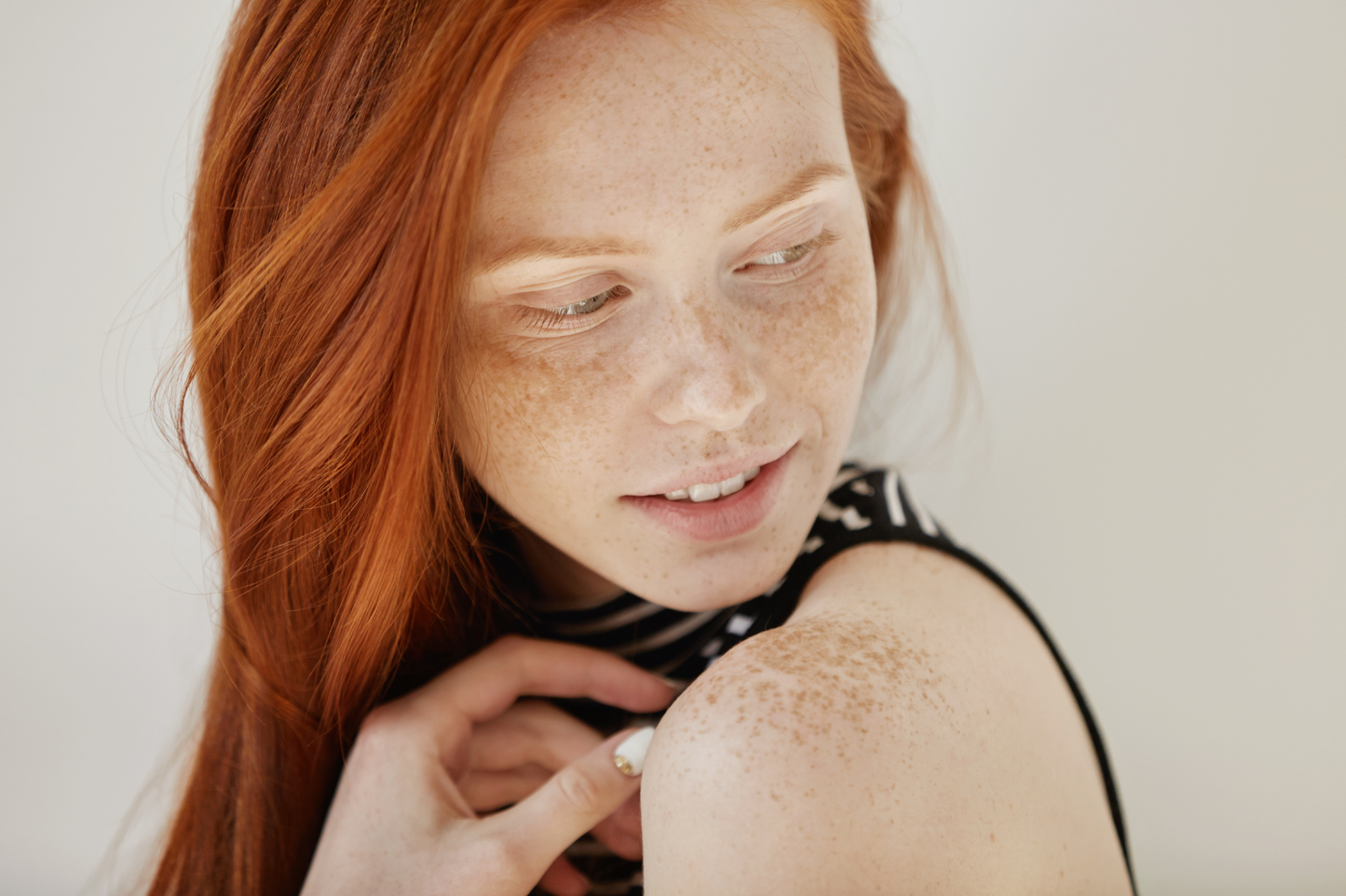 What Do Sun Spots Look Like