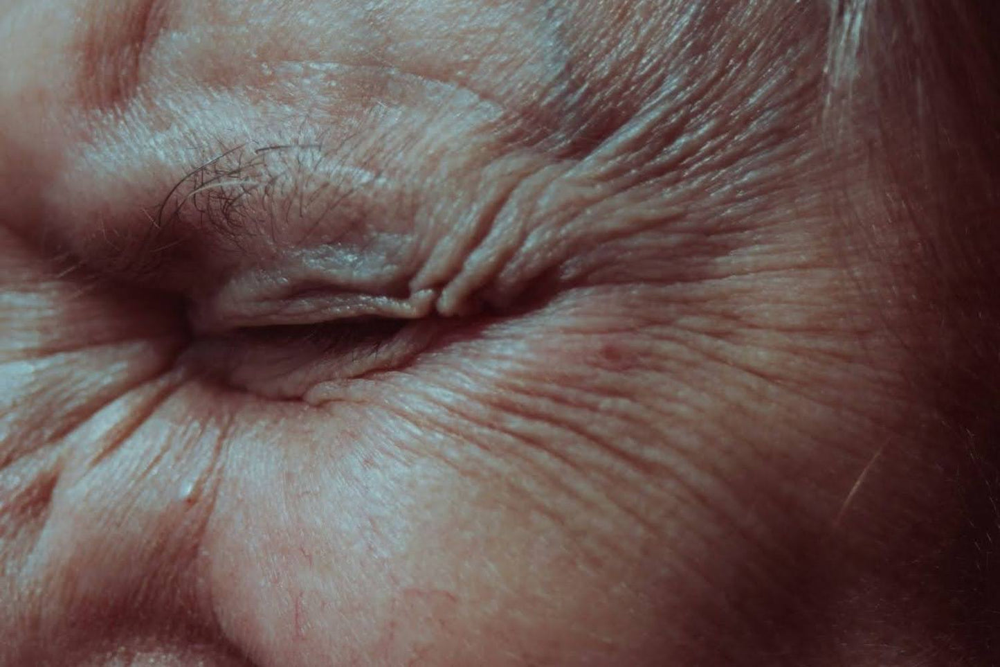 Alcohol has an impact on  skin aging