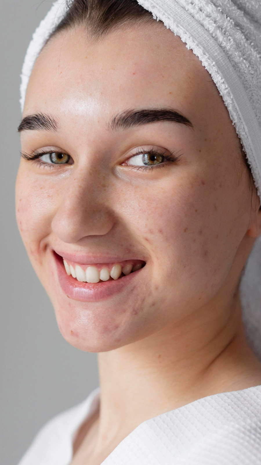 Acne Skin Care Products