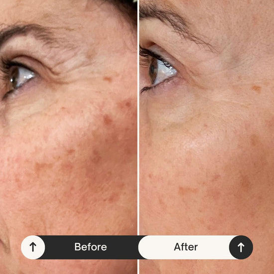 Brighten X - Non Hydroquinone