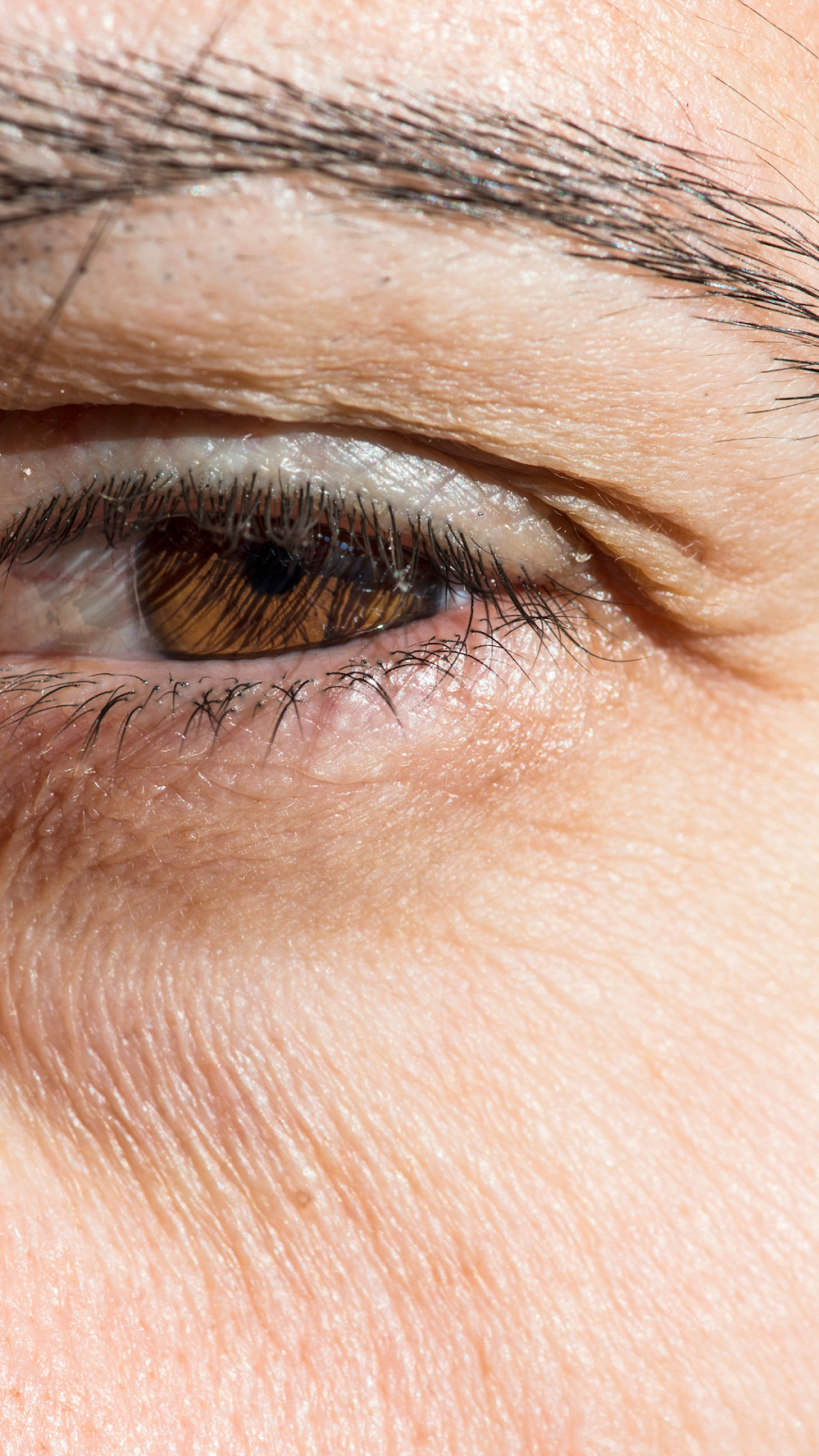 Best Eye Cream For Wrinkles And Dark Circles